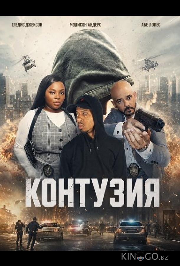 Контузия 